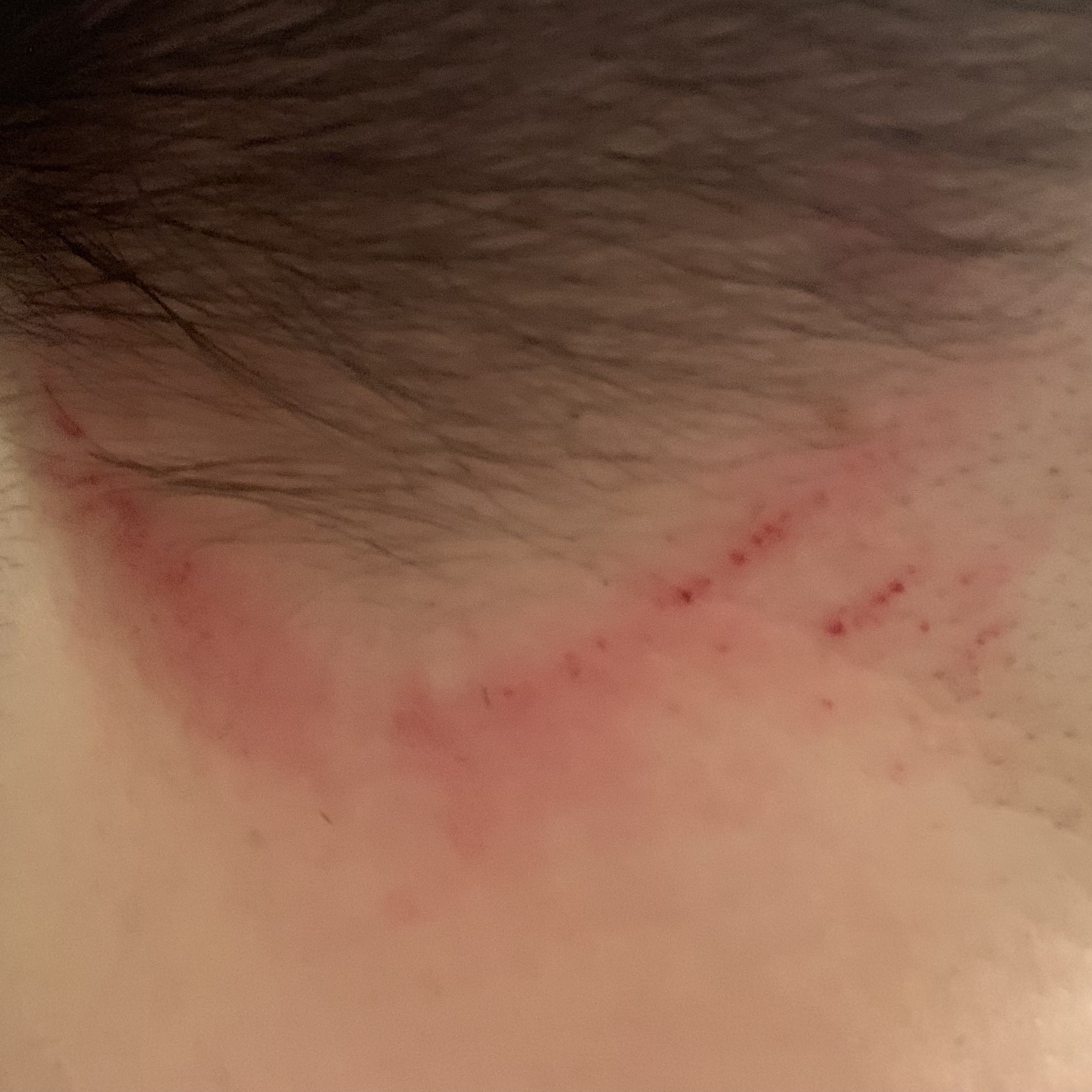 close-up of back of neck nicked by clippers