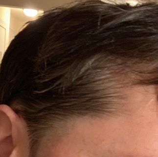 Close-up of side of head with uneven haircut